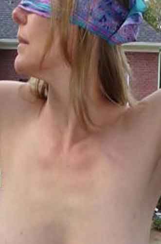 Anette, 45 år